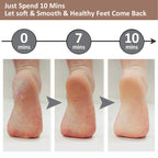 Salon like feets in 15 minutes with sofftouch Callus Remover