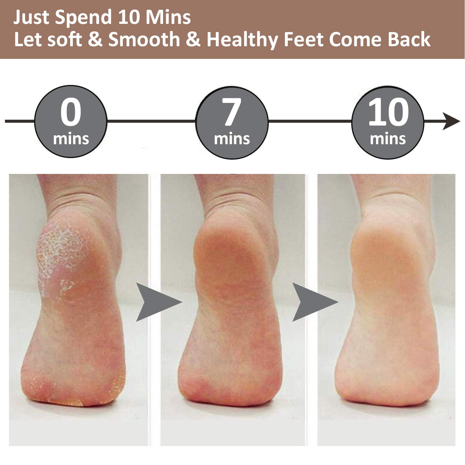Salon like feets in 15 minutes with sofftouch Callus Remover
